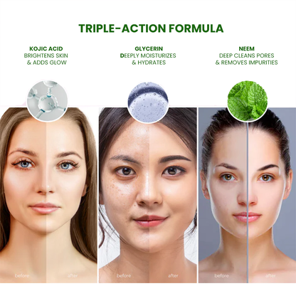 Glarenatural Pure Neem Glycerin Soap Herbal Protection