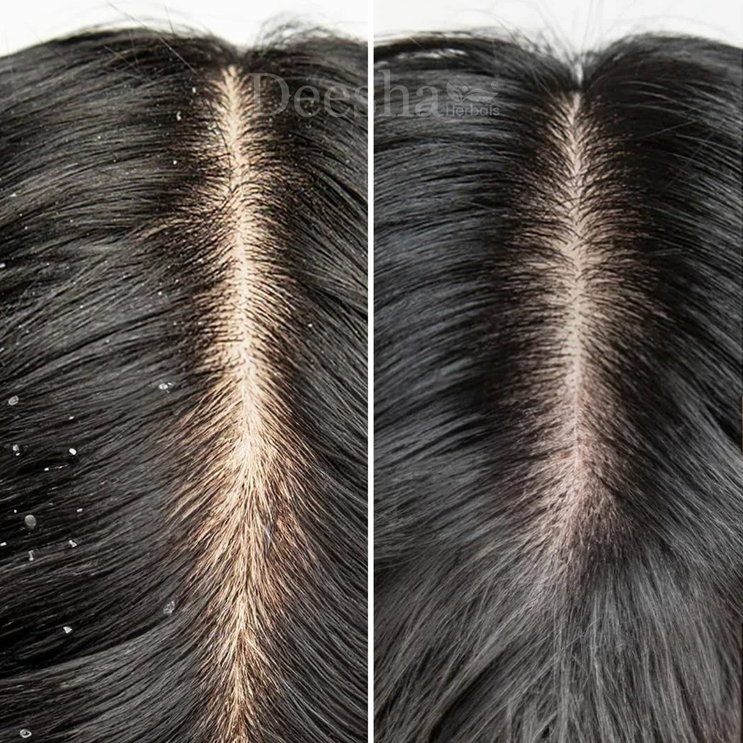 TRIPHALA+ Anti Dandruff Shampoo