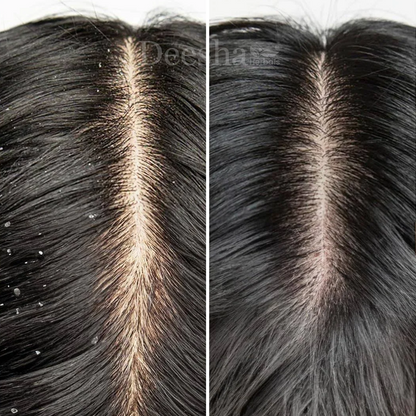 TRIPHALA+ Anti Dandruff Shampoo