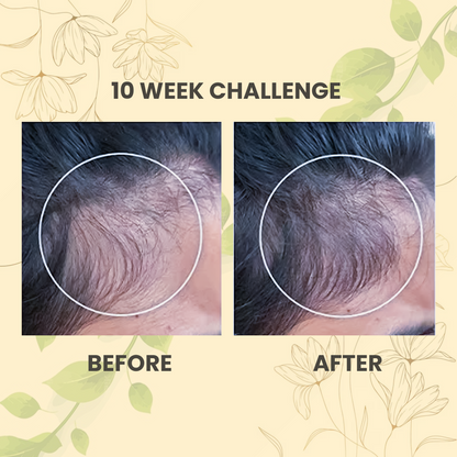 Root Revival Hair Oil